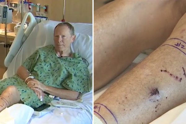 Pohrýzol ho štrkáč, no 75-ročný cyklista jazdil ešte ďalších 30 minút