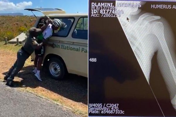  Juhoafrickému profesionálnemu cyklistovi zlomili ruku pri zatýkaní. Ruku si údajne zlomil sám (video)