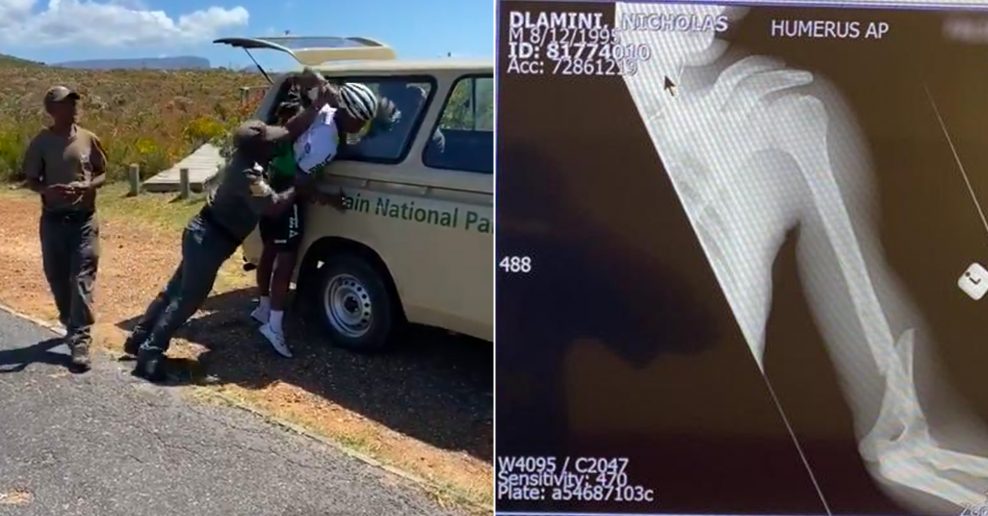  Juhoafrickému profesionálnemu cyklistovi zlomili ruku pri zatýkaní. Ruku si údajne zlomil sám (video)