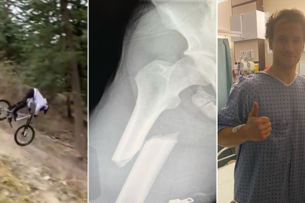  Tom Van Steenbergen nedoletel roadgap, pri páde si zlomil stehennú kosť, rebro a prepichol pľúca (+video)