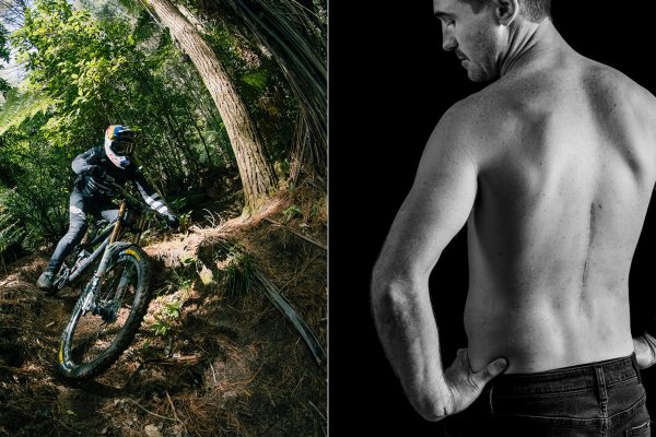  Musíte vidieť: Brook Macdonald v dokumente o ceste po hrozivom páde a úraze chrbtice