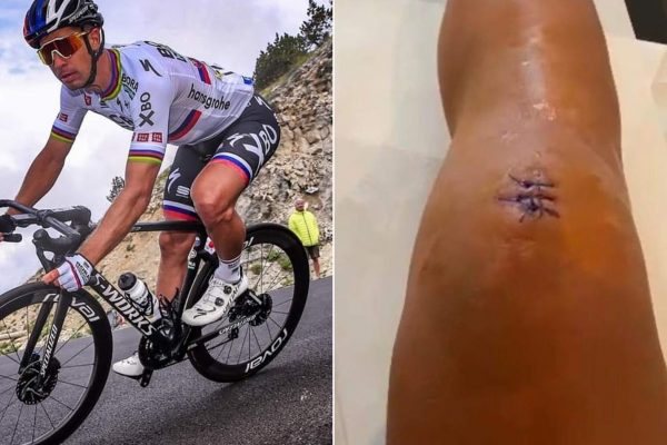 Peter Sagan musel podstúpiť operáciu kolena po skončení na Tour de France