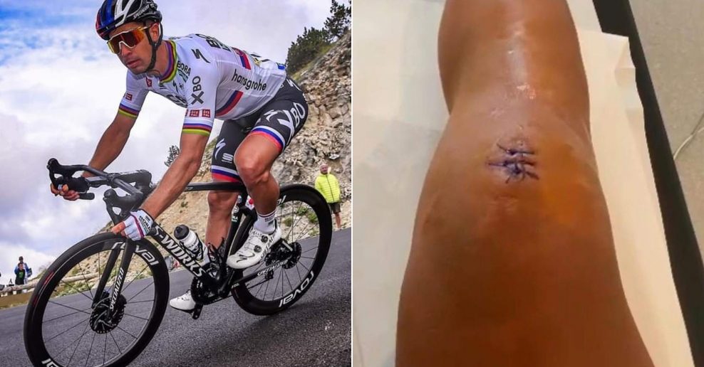 Peter Sagan musel podst&uacute;piť oper&aacute;ciu kolena po skončen&iacute; na Tour de France