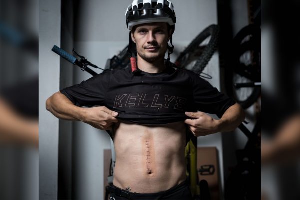 Zjazdár Rasťo Baránek nepríjemne spadol pri natáčaní a utrpel vnútorné krvácanie