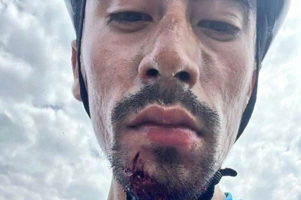 Kolumbijský cyklista Ivan Sosa bol napadnutý ozbrojeným kamionistom