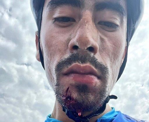 Kolumbijský cyklista Ivan Sosa bol napadnutý ozbrojeným kamionistom