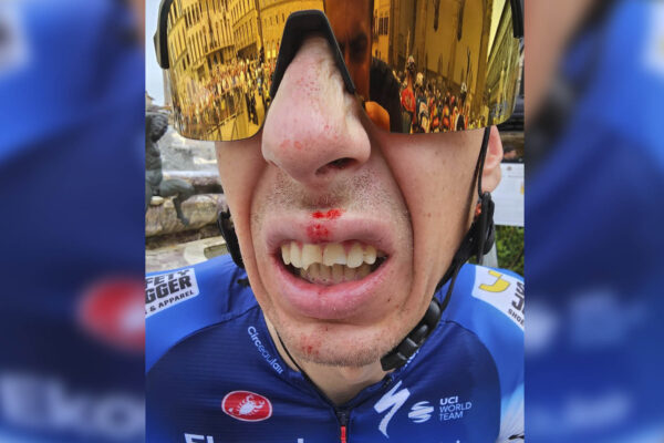 Jan Hirt spadol po strete s divákom a zlomil si tri zuby tesne pred štartom Tour de France