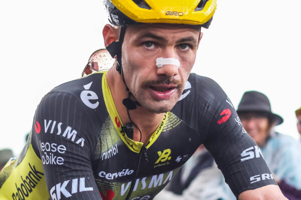 N&aacute;plasti na nos už asi nestačili. Victor Campenaerts si dal pred Vueltou epilovať chlpy v nose