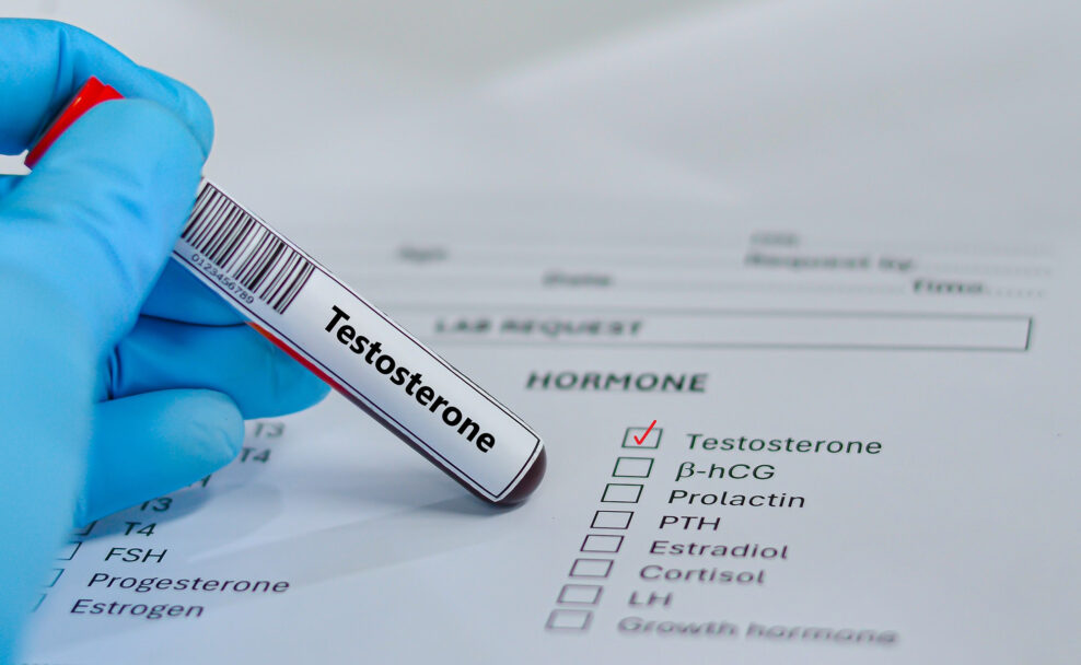 3 varovn&eacute; sign&aacute;ly n&iacute;zkeho testoster&oacute;nu a prečo s&uacute; jedin&eacute;, na ktor&yacute;ch najviac z&aacute;lež&iacute;?