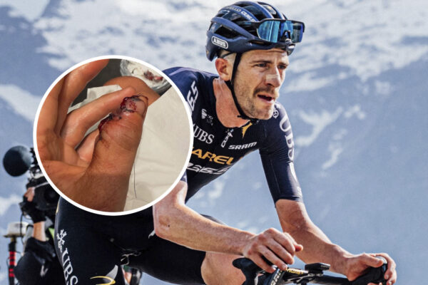 Chris Harper prišiel o časť palca pri páde na Tour de France: Aspoň som teraz o desať gramov ľahší