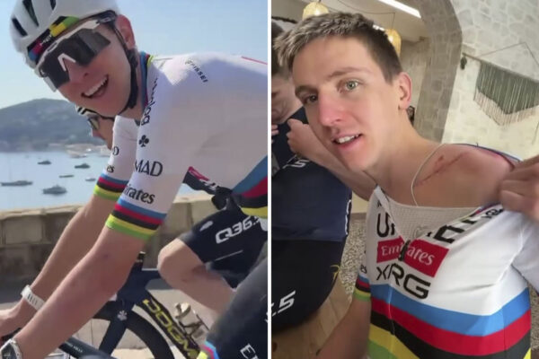 Tadej Pogačar sa po zranení vrátil k tréningom na bicykli. Ukázal aj jazvu po operácii kľúčnej kosti
