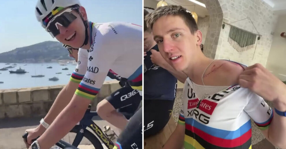 Tadej Pogačar sa po zranen&iacute; vr&aacute;til k tr&eacute;ningom na bicykli. Uk&aacute;zal aj jazvu po oper&aacute;cii kľ&uacute;čnej kosti