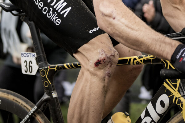 Bolia vás kolená pri jazde na bicykli? Toto sú najčastejšie príčiny a možnosti riešenia